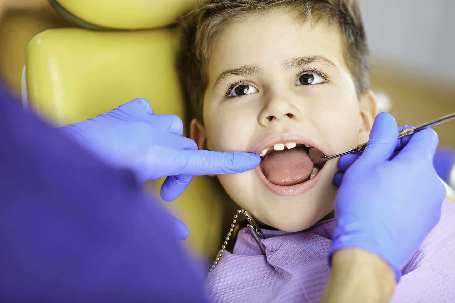 Root Canal Treatment for Primary (Baby) Teeth at Newburyport Pediatric Dentistry